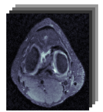 Preview for Memory-Efficient Learning for Unrolled 3D MRI Reconstructions