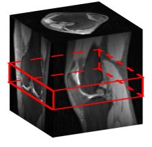 Preview for Memory-efficient Learning for High-Dimensional MRI Reconstruction